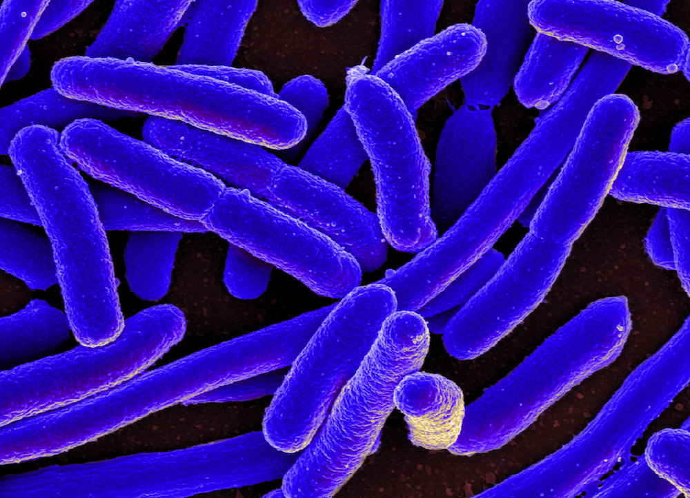 08-04 Escherichia coli