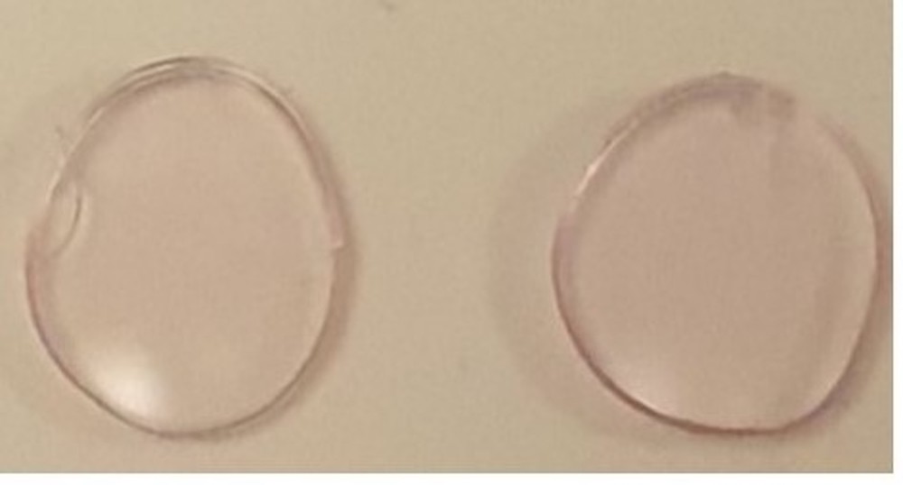 03-05 gold nanoparticle contact lenses